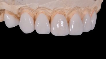 Esthetique dentaire